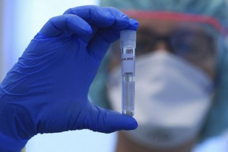Azərbaycanda son sutkada koronavirusa yoluxanların sayı açıqlandı