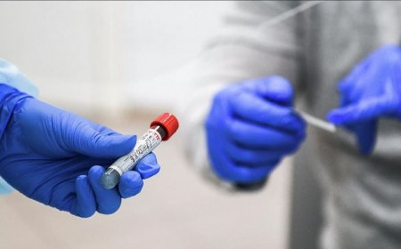 Rusiyada koronavirusa yoluxanların sayı 8 885 nəfər artdı