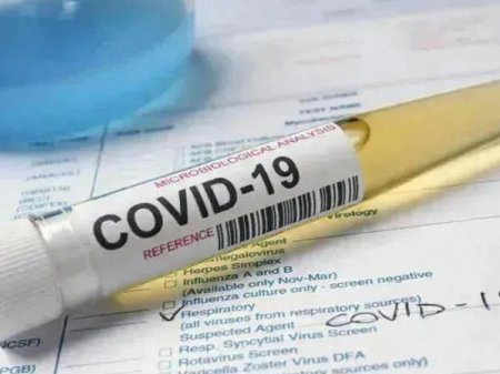 Pandemiyada məclis aparan azərbaycanlı müğənni koronavirusa yoluxdu, xəstəxanaya düşdü